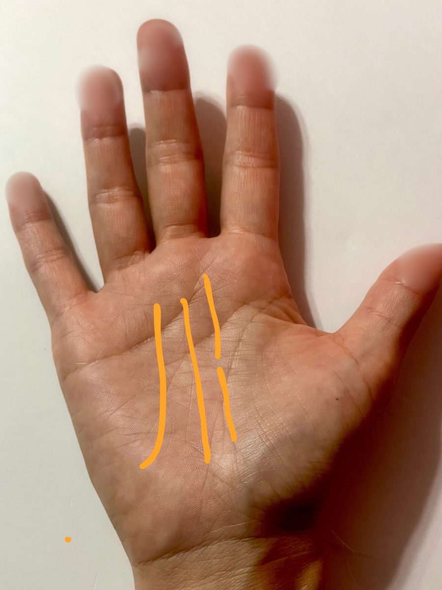 手のひらの写真。運命線の位置をオレンジの線で示している