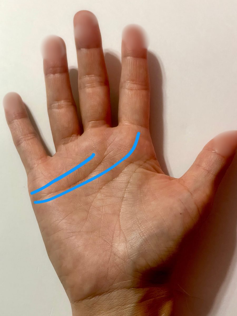 手のひらの写真。感情線の位置を青い線で示している